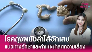 โรคถุงผนังลำไส้อักเสบเกิดจากสาเหตุอะไรบ้าง