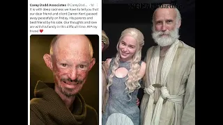 Darren Kent passed away Know cause of the actor s death