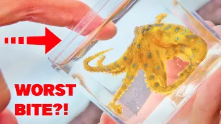 deadliest bite on earth blue ring octopus