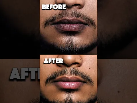 "😳Dark Lips Ka Real Solution? | #darklips #lipbalm #menfashion