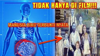 ini aneh tapi terjadi keturunan manusia berkulit biru nyata ada gen alien 