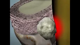 شرح جفاف الغضروف و الشفاء من الالم يشرحه اذ محمد يسري استاذ علاج الم الفقرات و المفاصل بدون جراحه  شرح جفاف الغضروف و الشفاء من الالم يشرحه اذ محمد يسري استاذ علاج الم الفقرات و المفاصل بدون جراحه