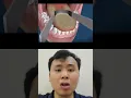 Download Lagu Penyebab Bau Mulut Berasal Dari Lidah Juga Loh Guys 🤢🤢🤮🤮 || #SHORTS