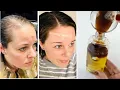 Download Lagu Put this ingredient in your shampoo,🌱It speeds up hair growth and treats baldness