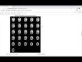 SimpleITK A Simplified Path to Insight Tutorial Results Visualization
