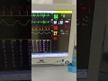 Download Lagu Monitor Icu #intensivecareunit