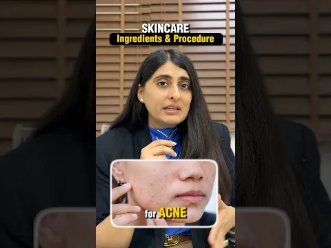Acne treatments and procedures| Best Creams for Acne