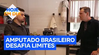 Após amputação dos quatro membros, brasileiro desafia limites e inspira outras pessoas