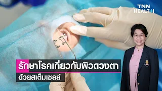 โรคผิวดวงตาที่เกิดจากอุบัติเหตุหรือการแพ้ยา มีอาการอย่างไรบ้าง