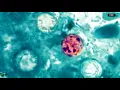 FDA updates cyclosporiasis case counts