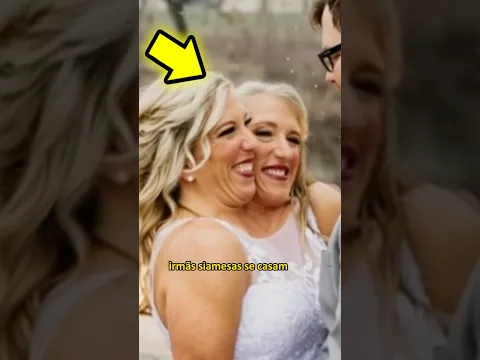 Irmãs siamesas se casam e todos ficam de boca aberta ao verem a cara do noivo!