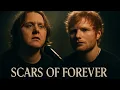 Download Lagu Lewis Capaldi ft. Ed Sheeran – Scars of Forever (2025 Official Music Video) OUT NOW!!! @EternaFM 