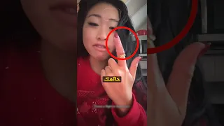 كيفية ازالة الخاتم العالق في الاصبع             دندنها