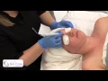 Galvanic Desincrustation Facial Technique Associated Skin Care Professionals