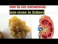 mm to cm mm Stone in kidney mm to cm conversation mm cm kya hota hai centimeters to millimeters