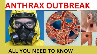 Download Latest Anthrax disease breakout, Anthrax mode of transmission, Anthrax prevention, and treatments MP3