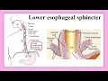 lower esophageal sphincter