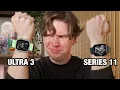 Download Lagu Apple Watch Series 11 VS Ultra 3 - DON'T BE FOOLED!