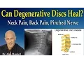 Download Lagu Can Degenerative Discs Heal Normal Again?  (Neck Pain, Back Pain, Pinched Nerve) - Dr Mandell