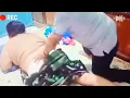 Pijat Mbah Maryono menang banyak nie#massage#tantepijat