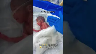 طفل مولود بالشهر الخامس  تمريض  حضانه  متابعة دندنها