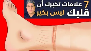7 علامات في جسمك تشير إلى أن قلبك قد لا يكون على ما يرام 7 اعراض لمشاكل القلب 