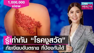 โรคงูสวัสดิ์เกิดจากสาเหตุอะไรบ้าง