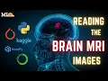 5-Reading the Brain MRI images in Python