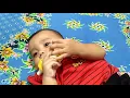 Download Lagu Udel bodong atau pusar menonjol saat usia 6 bulan.
