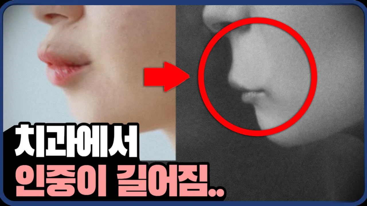 ()교정을 했는데 더 별로가 된 이유 ㅣ 강남 치과 원장이 알려드립니다.