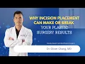 Why Incision Placement Can Make or Break Your Plastic Surgery Results Dr Oliver Chang MD