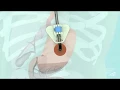 Download Lagu PEG sonde - Ziekenhuis Gelderse Vallei