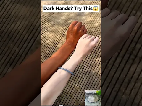 😱Full Hand Whitening Tips| All Clean Dirt & Tan | #shorts #deadskin #skincare #beautiful #viral