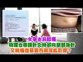 Download Lagu 東張西望｜女事主肩膊痛 物理治療師針灸時卻向腿部施針 又稱痛症是由內臟混亂影響？｜肩膊痛｜物理治療師｜針灸｜內臟混亂｜廖倬竩｜俞可程