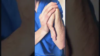 كسر مفصل اليد 