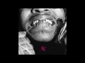 Injury Reserve - S on Ya Chest