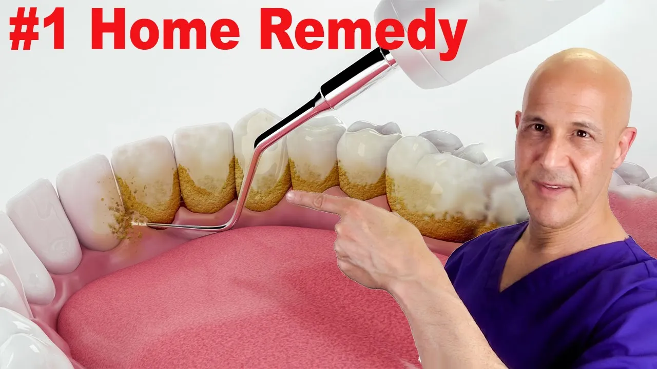 Outline Video #1 Home Remedy to Remove Dental Plaque & Tarter to Prevent Cavities | Dr. Mandell
