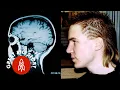 Download Meet the Accidental Genius mp4 3gp mp3 videos - waplic