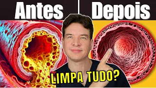 Discover the TEST that can save your heart – Are your arteries at RISK? (unclog your arteries)