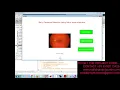 Early Glaucoma Detection Using Naive bayes algorithm