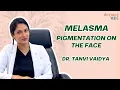 What is Melasma Treatment for Melasma Dermatologist Explains Dr Tanvi Vaidya