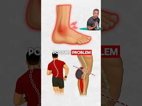 How Tight Ankles Ruin Your Posture