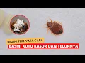 Cara Membasmi Kutu Kasur Busuk dan Telurnya