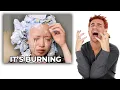 Hairdresser Reacts To Chemical Burn Bleach Fails