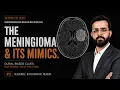 The Meningioma Playbook How to Recognize It on Every Sequence Neuroradiology Masses