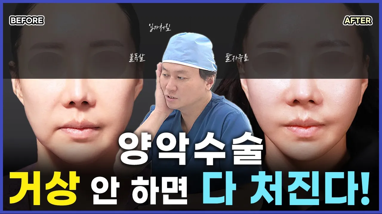 양악수술 후 거상 안 하면 다 처진다는 게 사실인가요? #안면거상 #거상수술 #코재수술