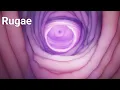 what is rugae How aging can affect the vagina Rectum Bladder and gallbladder
