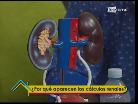 ¿Porqué aparecen los cálculos renales?