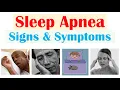 Download Lagu Sleep Apnea Signs \u0026 Symptoms (\u0026 Why They Occur) | Central, Obstructive \u0026 Mixed Sleep Apnea
