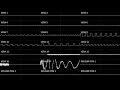 Download Lagu Mayhem Syndicate Beat [Commander X16 VERA + Konami K053260, Oscilloscope View]